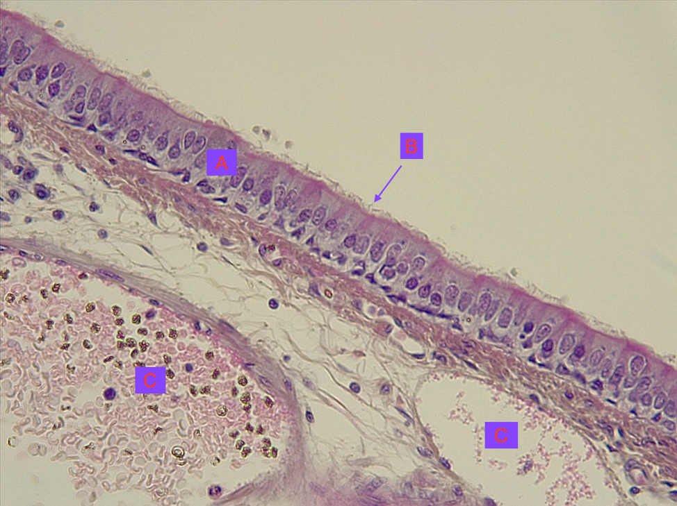 Respiratory Histology – MVCC Anatomy And Physiology