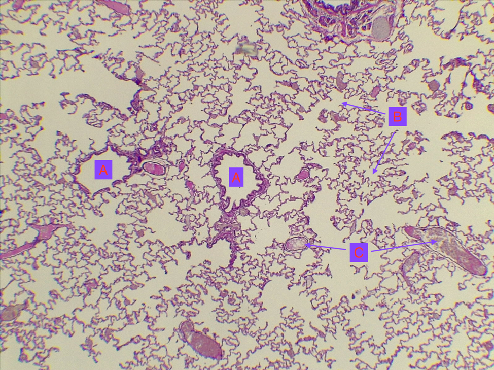 Respiratory Histology – MVCC Anatomy And Physiology