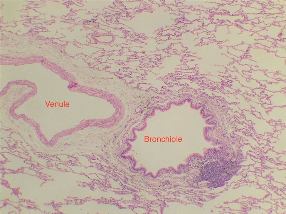 Respiratory Histology – MVCC Anatomy And Physiology